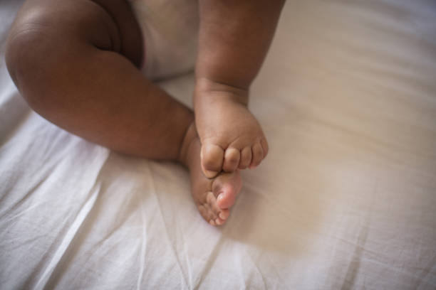 You are currently viewing New born baby loses leg at Parirenyatwa in a case of hospital negligence